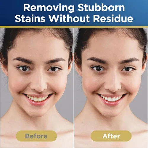 Vista 6 de Tiras blanqueadoras, tira blanqueadora de dientes, 60 tiras para dientes sensibles, kit de blanqueamiento dental profesional y seguro