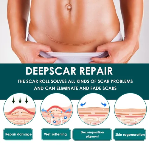 Vista 4 de Cinta de silicona para cicatrices, láminas de gel de silicona premium (rollo de 1.6" x 60" - 1.5M), parches de silicona reutilizables, cinta