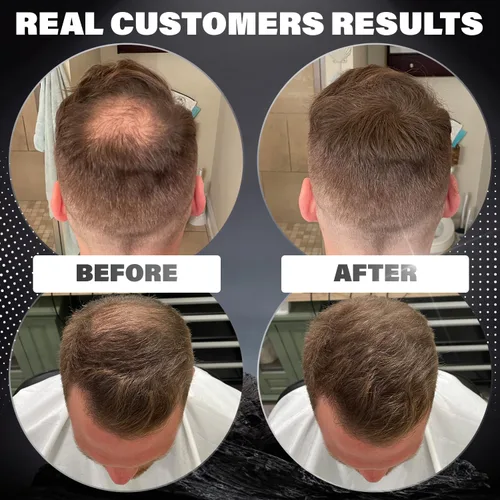 Vista 3 de Fibras para adelgazar el cabello (rubio claro), polvo de cabello indetectable para hombres y fibras 100% naturales para construir el cabello, oculta