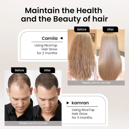 Vista 4 de Suplemento para el crecimiento del cabello, apoyo para el cuidado del cabello para fortaleza, crecimiento de espesor, con biotina vitamina A, C, E