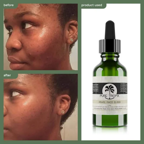 Vista 4 de Pure Tropix Pearl Face Elixir: Tónico que aprieta los poros + reduce la opacidad + establece maquillaje Elixir facial con aceites orgánicos