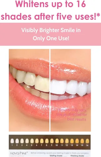 Vista 2 de Novashine Kit profesional de blanqueamiento de dientes: luz LED azul avanzada, gel de peróxido concentrado, adaptador para teléfono inteligente
