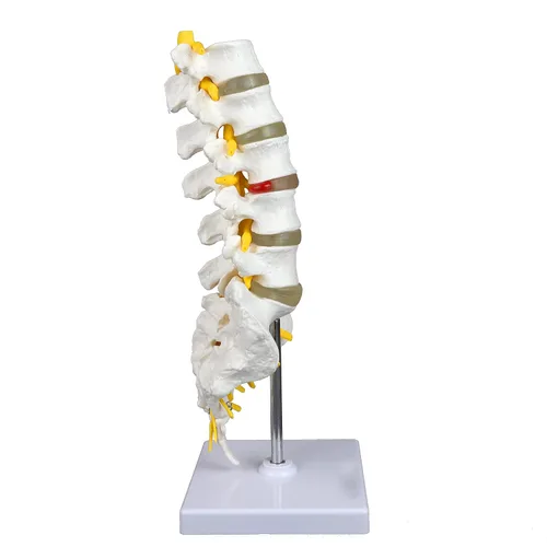 Vista 4 de Vision Scientific Columna vertebral lumbar articulada de grado médico VAV262 Cuenta con 5 lumbares/vértebras con discos intervertebrales, nervios