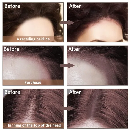 Vista 4 de Boobeen Polvo de línea capilar para cubrir las raíces al instante, sombra de cabello, impermeable, corrector de raíces para adelgazar el cabello