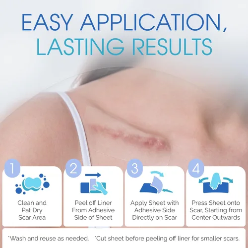 Vista 6 de Hojas de silicona para cicatrices de grado médico, cinta de silicona para cicatrices quirúrgicas, hojas de gel transpirables duraderas