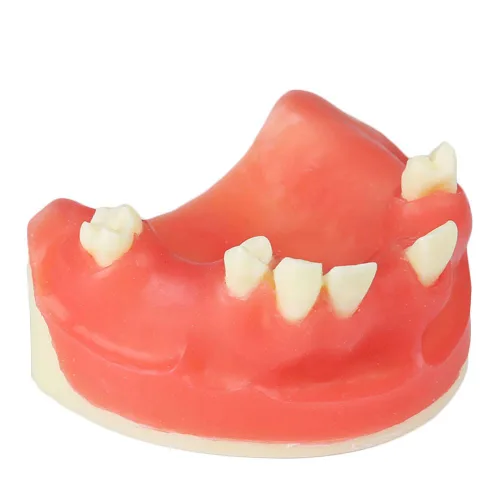 Modelo de implante maxilar rojo dental con modelo de educación modelo de práctica de silicona suave