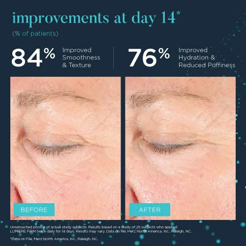 Vista 6 de NEOCUTIS Lumiere Firm Riche - Crema para ojos extra hidratante, iluminadora y tensora - 15 ml