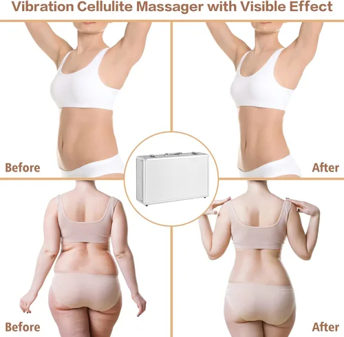 Vista 7 de Masajeador eléctrico de celulitis de vibración, masajeador de mano para eliminar celulitis, masajeador de cuerpo completo, masajeador de celulitis