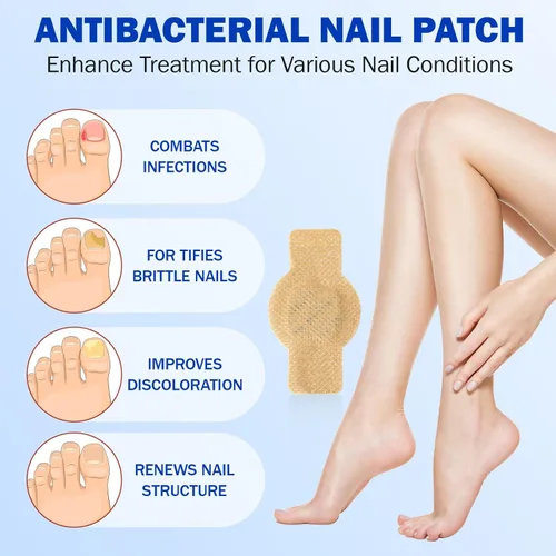 Vista 3 de Parches de uñas para reparación de uñas de los pies – 42 piezas de soporte de uñas durante la noche para uñas dañadas, gruesas o amarillas, fórmula