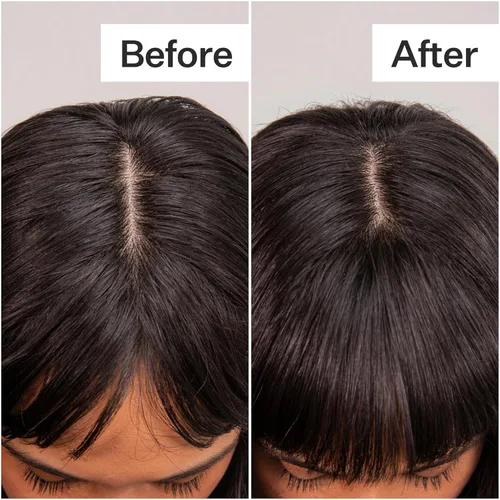 Vista 6 de ACT+ ACRE Plant-Based Fulvic Acid Volumizing Dry Shampoo - Natural and Unscented Powder Spray Shampoo with Fulvic Acid and Rice Refresh Oily Hair