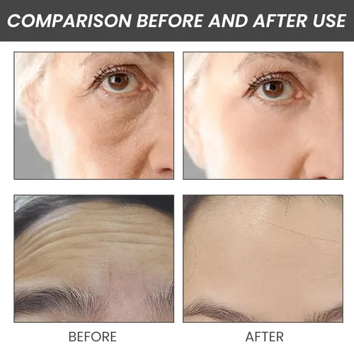 Vista 4 de Suero de relleno rápido de escualano y péptido de cobre, esencia de concentración rápida de esencia de péptido de cobre de escualeno, rellena