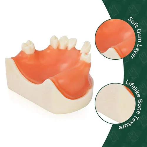 Vista 4 de Ultrassist Modelo de implante dental maxilar, modelo básico de entrenamiento de implantes con práctica de encías blandas, gran diente