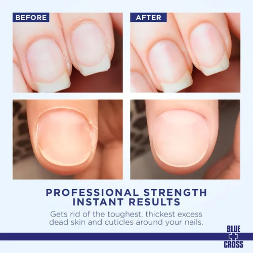 Vista 2 de Crema Removedora de Cutículas Blue Cross para Cutículas Secas y Dañadas, Suavizante Hidratante de Cutículas para Uñas, Cuidado Profesional de Uñas