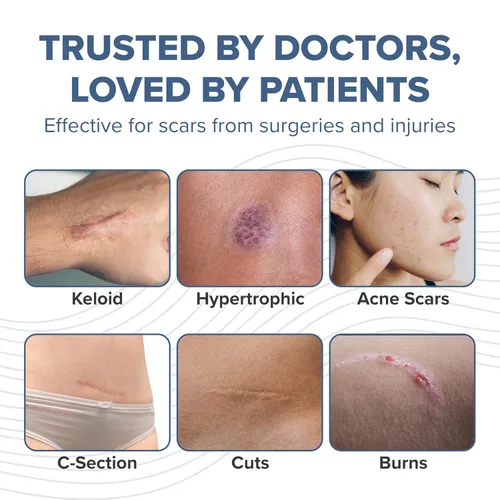 Vista 7 de Biodermis Pro-SIL - Barra de gel de silicona para cicatrices, cuidado de reducción de cicatrices para cirugía, acné, cicatrices de traumatismos