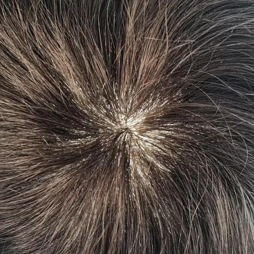 Vista 70 de Men's 8X10 All Poly Toupee Real Human Hair Replacement System, 0.1mm Thin Skin PU Injected Hairpiece, Scallop PU Front Natural Hairline #1 Jet