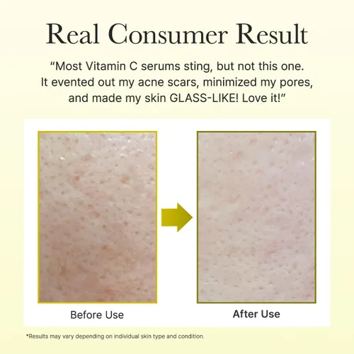 Vista 7 de Arencia Suero de Impulso de Vitamina C con Glutatión, Niacinamida y Vitamina E para Piel Luminosa 1.01 fl oz