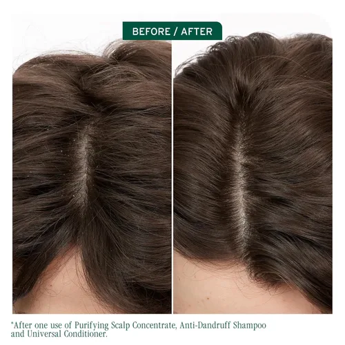 Vista 2 de Biolage Scalp Sync Anti-Dandruff Shampoo - Controls Itchy Scalp, Deeply Cleanses Hair, Moisturizing Dandruff Treatment, With Zinc Pyrithione, Vegan