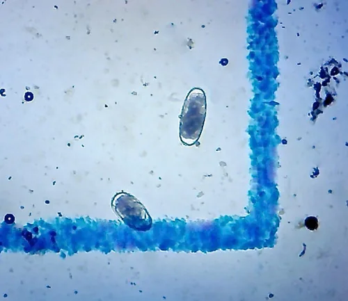 Vista 2 de McMaster Method Microscope Slide - FEC (recuento de huevos fecales) o recuento de gusanos, diapositiva de doble cámara para pruebas y manejo