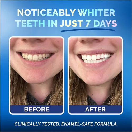 Vista 5 de Tiras blanqueadoras para dientes sensibles, sin esmalte, sin peróxido, tiras blanqueadoras de dientes con enzimas naturales, puntas blancas suaves