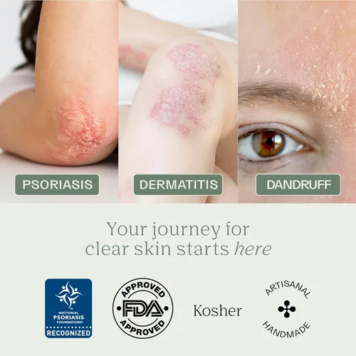 Vista 7 de Barra de jabón Dermabon para el control de la psoriasis, dermatitis y caspa con 2% de alquitrán de hulla como ingrediente activo - 1 paquete