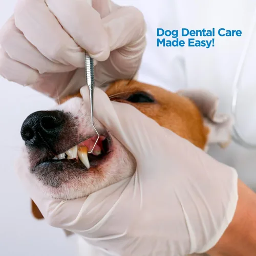 Vista 6 de 4tified Herramientas dentales Kit de higiene 4 piezas de acero inoxidable francés profesional limpieza de dientes uso doméstico placa eliminación