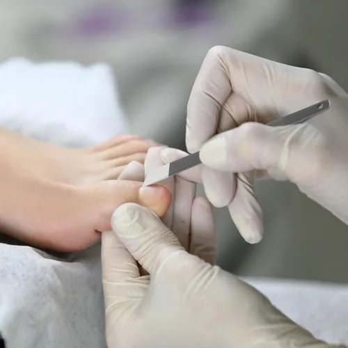 Vista 3 de HEALLILY Kit de herramientas de pedicura profesional, cuchillos para uñas de los pies, removedor de cutículas, juego de cuchillos de uñas