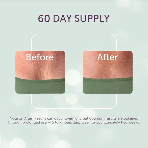 Vista 3 de Silc Skin Decollette Pad - Parches antiarrugas para el pecho de grado médico para líneas de sueño y daños por el sol, almohadilla de pecho