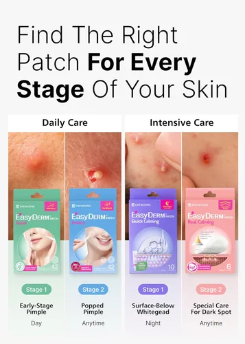 Vista 3 de EasyDerm - Juego variado de parches para el acné de 4 tipos y herramienta 2 en 1 para reventar espinillas
