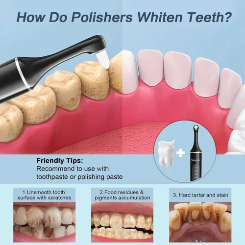 Vista 2 de Tooth Polisher,Rechargeable Tooth Whitening Kit for Teeth Cleaning and Whitening, with 8 Brush Heads, LED Light, 5 Speed Modes Dental Polisher