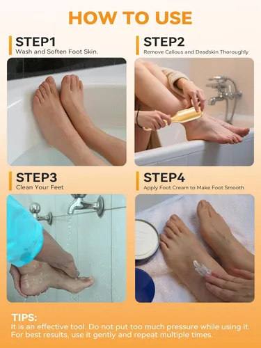 Vista 7 de Beyond The Cream Veins - Lima de pie de grano de nano, removedor de callos de piel dura, herramienta de pedicura profesional, cuerda de mango