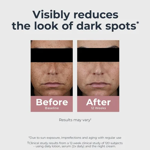 Vista 4 de Eucerin Radiant Tone - Suero dual corrector de manchas oscuras, suero de manchas oscuras con tiamidol y ácido hialurónico, ayuda a reducir