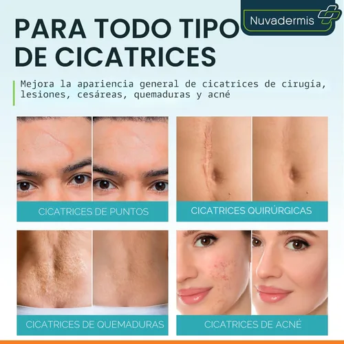Vista 5 de Nuvadermis Paquete de cuidado de cicatrices - Gel avanzado para cicatrices y cinta de silicona para cicatrices
