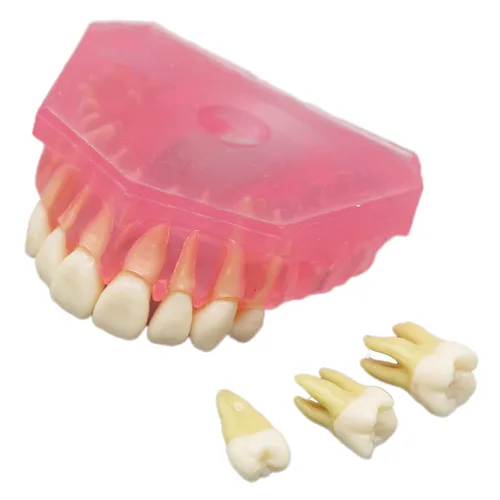 Vista 4 de Modelo de dientes de demostración dental - Estudio estándar de enseñanza dental con todos los dientes extraíbles #4004 Material de gel de sílice