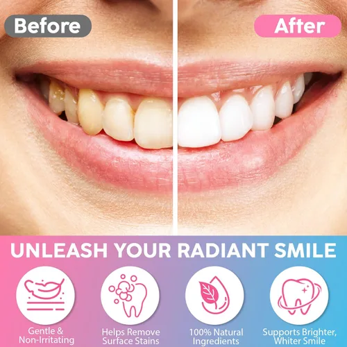 Vista 6 de Pasta de dientes blanqueadora de niacinamida, pasta de dientes de cuidado completo, elimina el sarro, elimina las manchas de los dientes, protege
