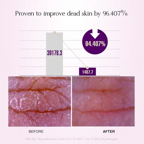 Vista 6 de Grape Gelato Pack Cleanser Limpiador exfoliante facial y corporal, suave con la piel, resistente con las células muertas, exfoliante a base