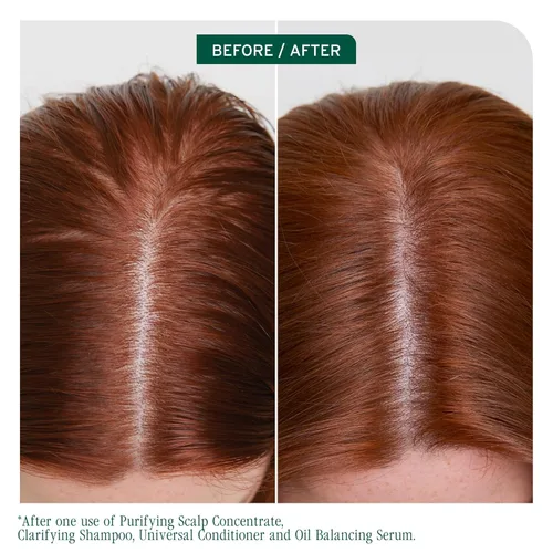 Vista 2 de Biolage Scalp Sync Clarifying Shampoo - Residue & Buildup Remover, For Oily Scalp