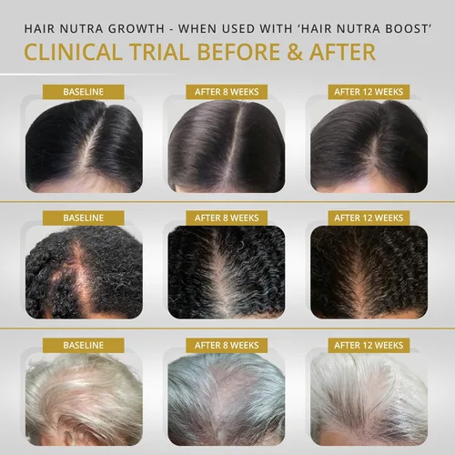 Vista 2 de VITAMINS REVIVE Suplemento vitamínico para el crecimiento del cabello para mujeres, fórmula vegana clínicamente probada en Estados Unidos, cápsulas