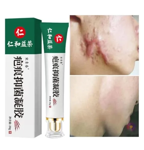 Vista 5 de Crema Para Cicatrices elimina las cicatrices de cara cuerpo cuida tu piel