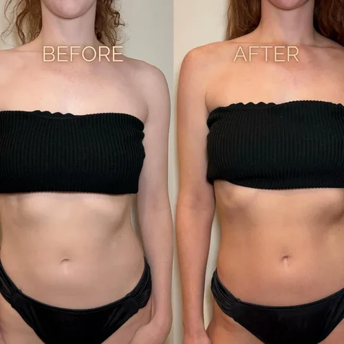 Vista 4 de SunFX Loción corporal bronceado gradual autobronceador Hidratante extensor de bronceado hidratante sin olor Construye tu brillo de sol a oscuro