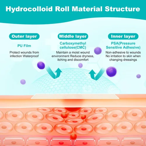 Vista 6 de Rollo hidrocoloide para el cuidado de heridas, vendajes hidrocoloides con vendajes autoadhesivos, cortados a medida, ultra absorbente, impermeable