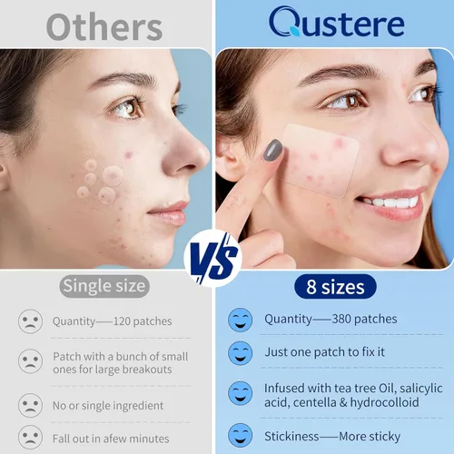 Vista 5 de QUSTERE Parches grandes para espinillas para cara, parches de acné hidrocoloide, vendajes hidrocoloides grandes, cubiertas de granos de formas