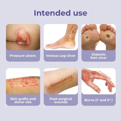 Vista 6 de Conkote Apósitos de espuma de silicona con borde, paquete de 10 vendajes adhesivos impermeables para el cuidado de heridas de exudado pesado de 4 x