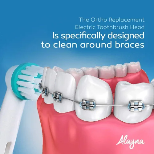 Vista 7 de Alayna Cabezales de cepillo de repuesto, compatibles con Oral-B Braun Professional Ortho Brush Head & Power Tip Kit - Paquete de 4 cabezales