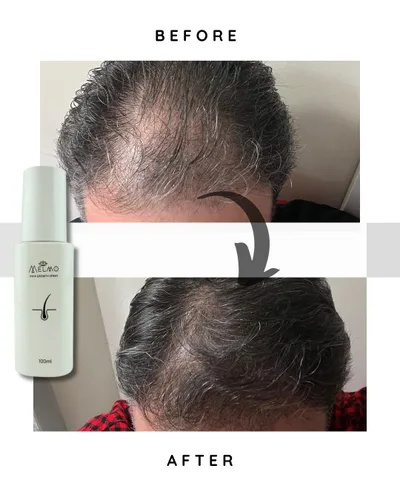 Vista 3 de Crecimiento del cabello para la pérdida del cabello, 3.4 fl oz de engrosamiento del cabello, productos hidratantes para el cuidado del cabello