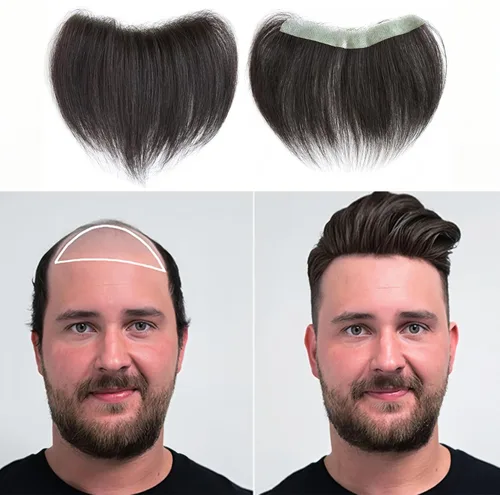 Vista 11 de Extensión frontal de cabello rubio claro para hombres, extensión de cabello lacio con pérdida de línea de cabello humano con cinta adhesiva